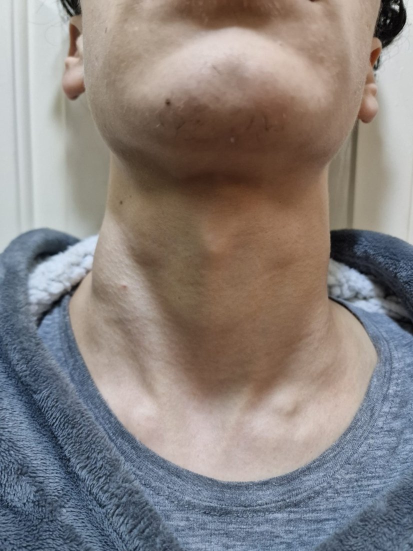 GECUyyFNNJDm5Iol.jpg