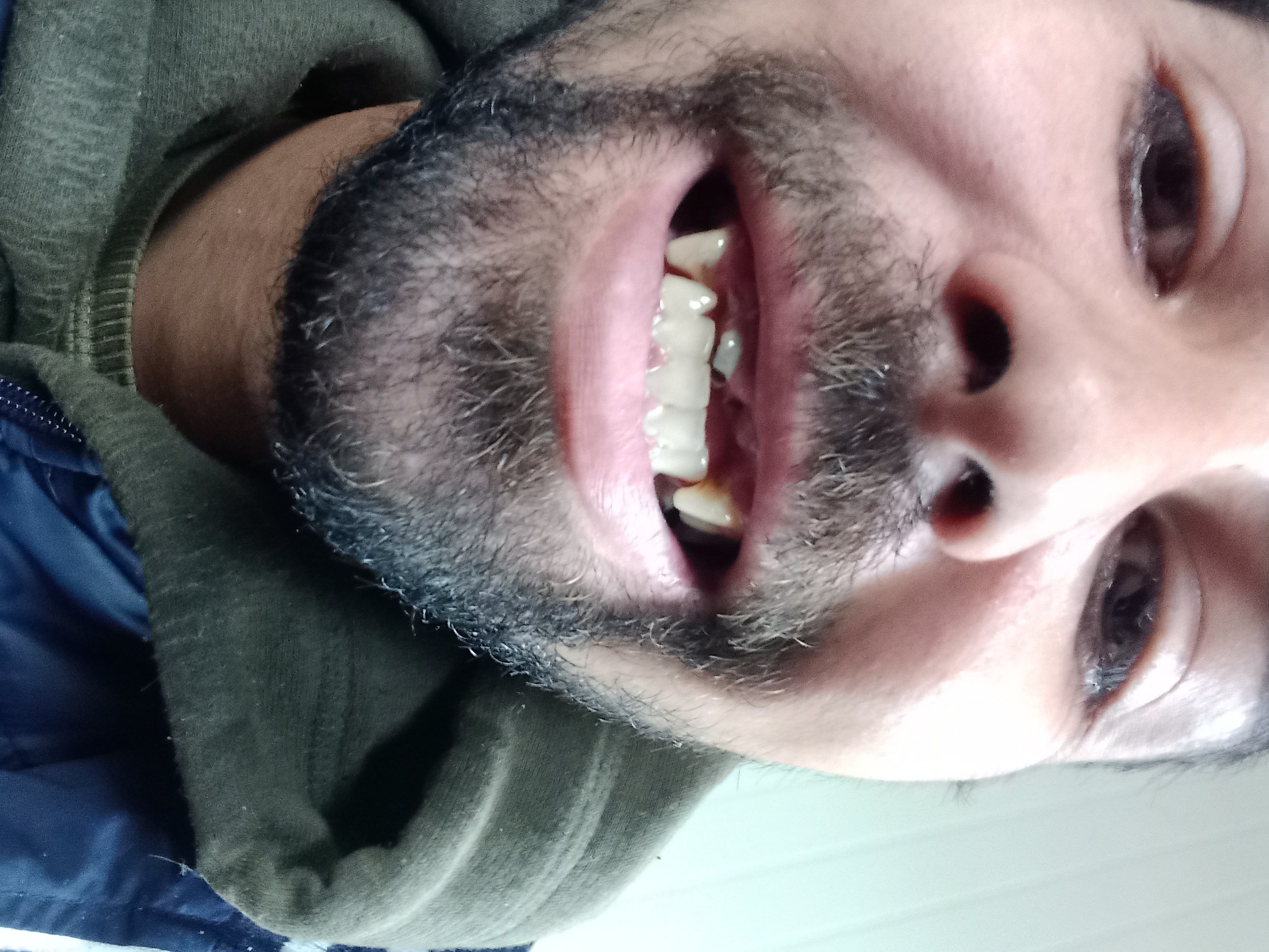 lCZiLAcdHL4Iqyql.jpg